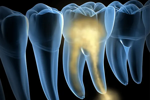 3 τύποι πόνου στα δόντια που δεν πρέπει να αγνοήσετε
