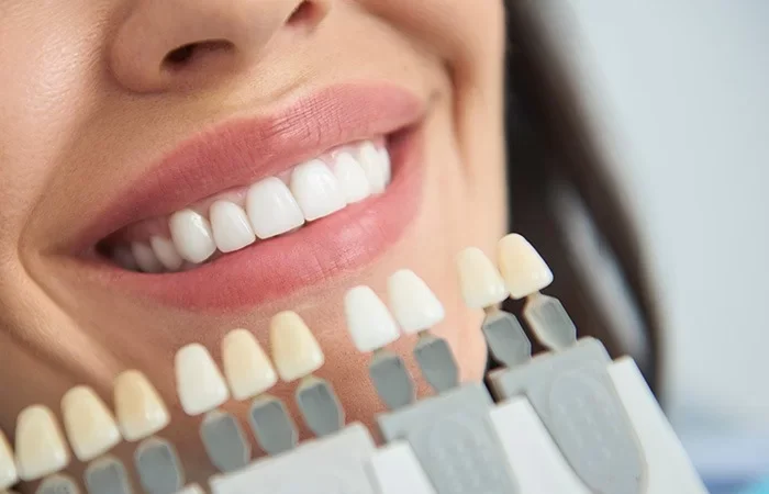 Η λεύκανση των δοντιών προκαλεί ευαισθησία στα δόντια;