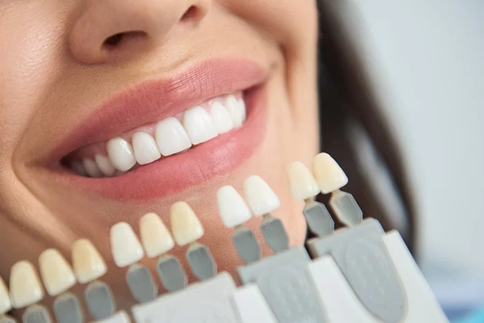 Η λεύκανση των δοντιών προκαλεί ευαισθησία στα δόντια;